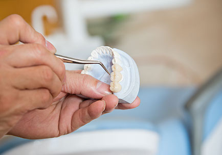 protese-dental-copacabana-2