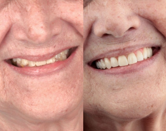 Paciente feliz após realizar protocolo dentário na Clínica Sorrio.